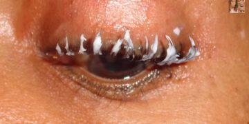 Permed Eyelashes