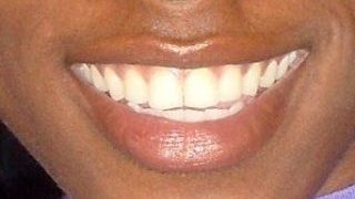 teeth