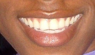 teeth